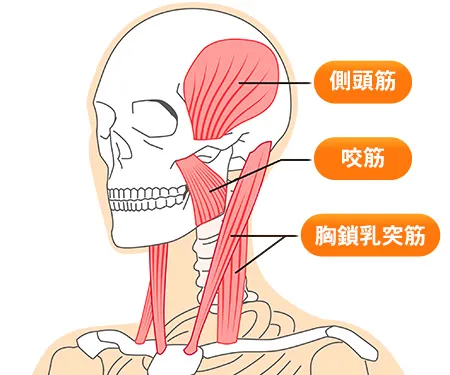 睡眠障害、偏頭痛