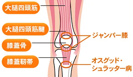 ジャンパー膝